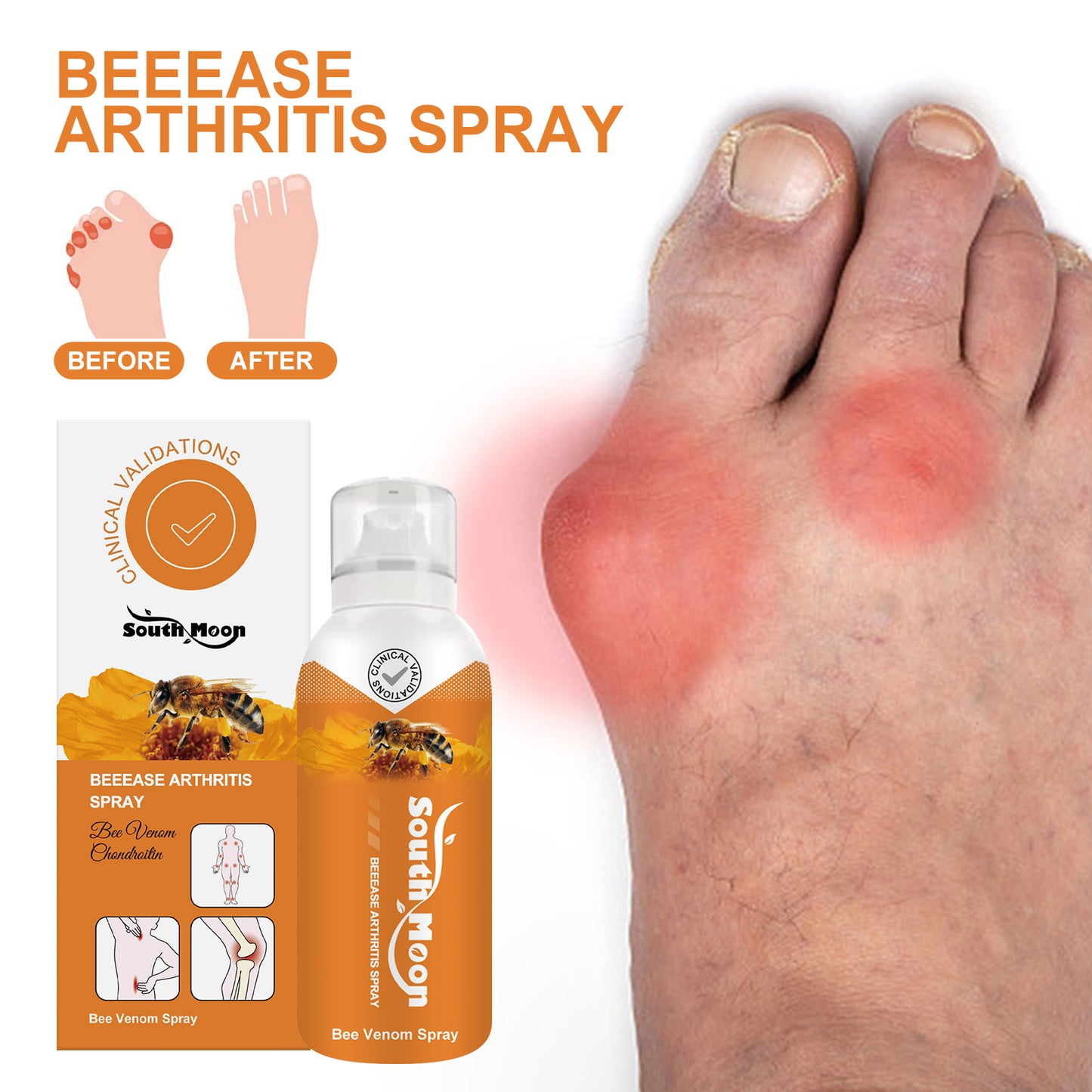 Beease Arthritis Relief Spray – Joint, Neck & Back Pain Care